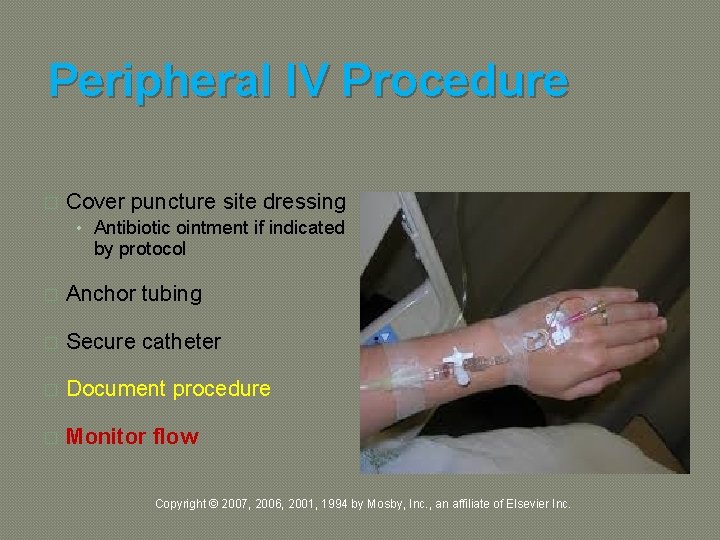 Peripheral IV Procedure � Cover puncture site dressing • Antibiotic ointment if indicated by