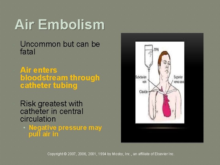 Air Embolism Uncommon but can be fatal Air enters bloodstream through catheter tubing Risk