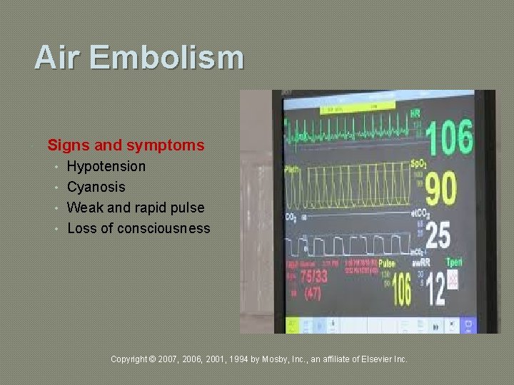 Air Embolism Signs and symptoms • Hypotension • Cyanosis • Weak and rapid pulse