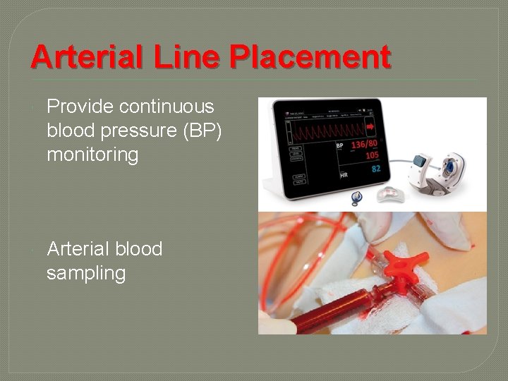 Arterial Line Placement Provide continuous blood pressure (BP) monitoring Arterial blood sampling 