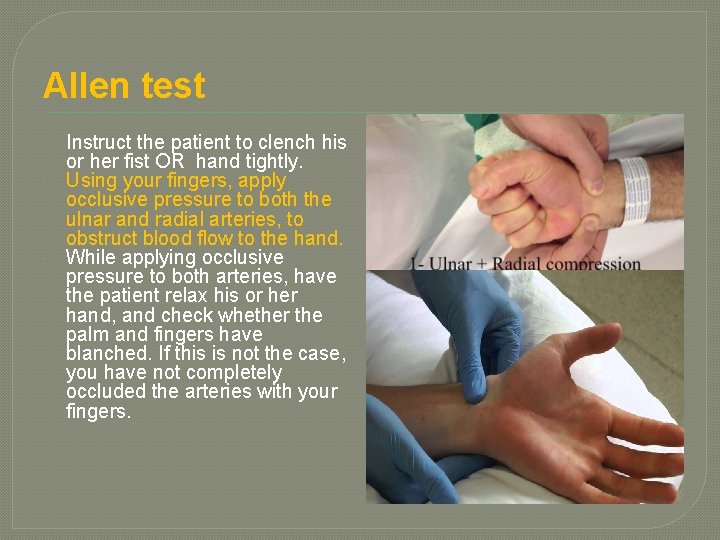 Allen test Instruct the patient to clench his or her fist OR hand tightly.