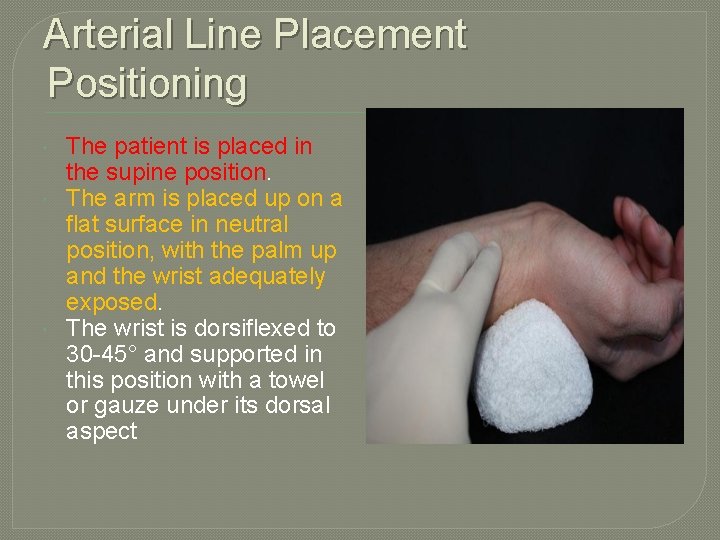 Arterial Line Placement Positioning The patient is placed in the supine position. The arm