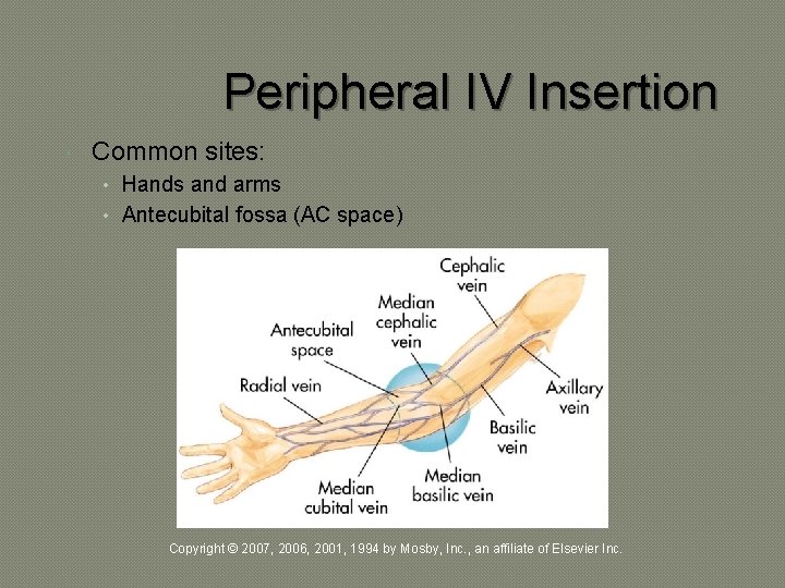 Peripheral IV Insertion Common sites: • Hands and arms • Antecubital fossa (AC space)