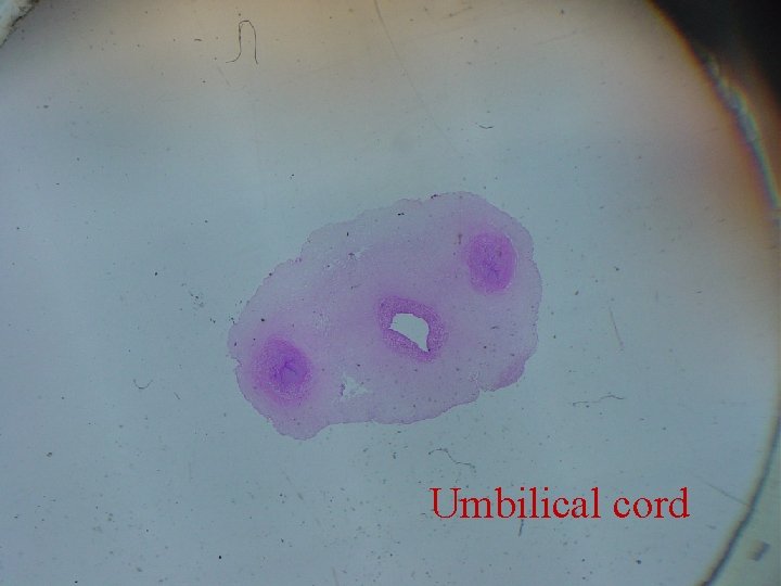 Umbilical cord 