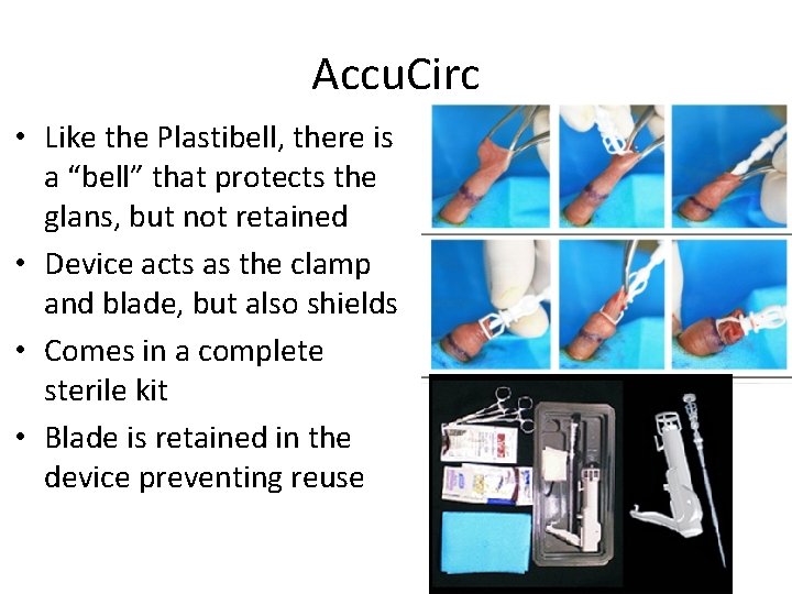 Accu. Circ • Like the Plastibell, there is a “bell” that protects the glans, Accu. Circ • Like the Plastibell, there is a “bell” that protects the glans,