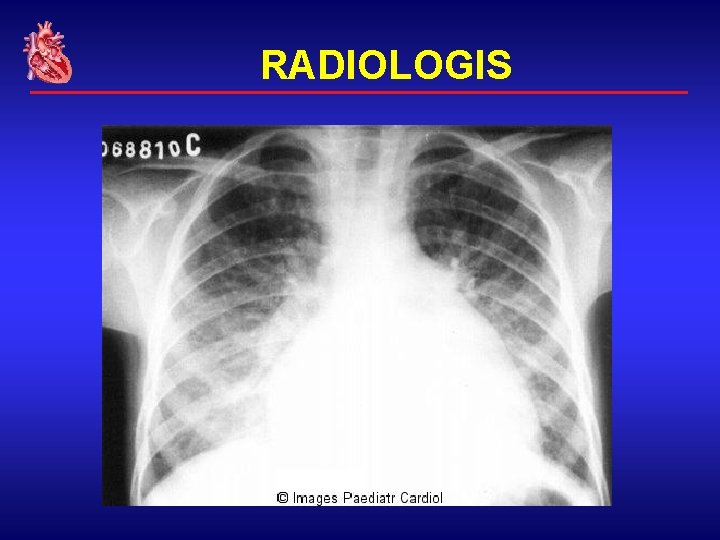 RADIOLOGIS 