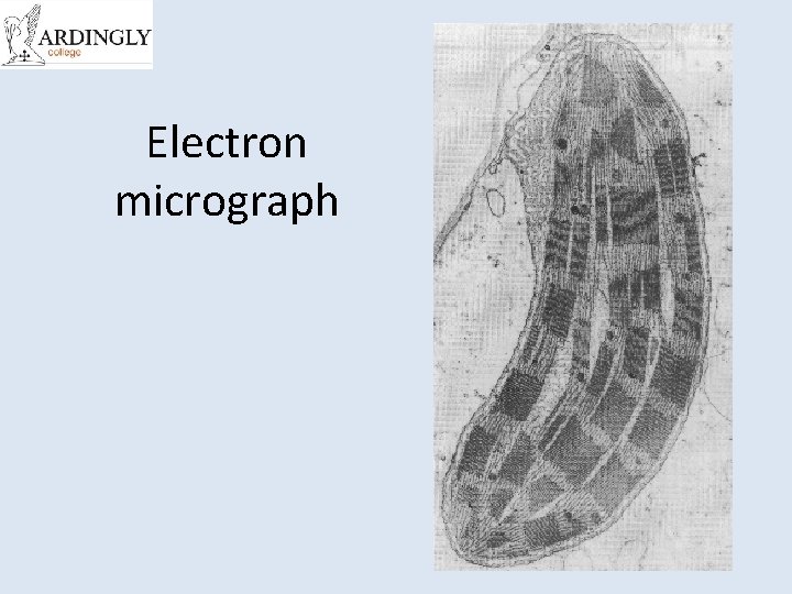 Electron micrograph 