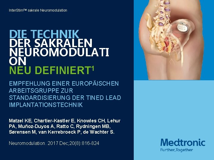 Inter. Stim. TM sakrale Neuromodulation DIE TECHNIK DER SAKRALEN NEUROMODULATI ON NEU DEFINIERT 1