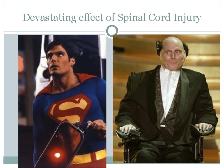Devastating effect of Spinal Cord Injury 
