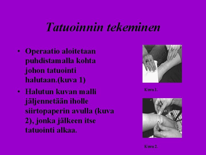 Tatuoinnin tekeminen • Operaatio aloitetaan puhdistamalla kohta johon tatuointi halutaan. (kuva 1) • Halutun