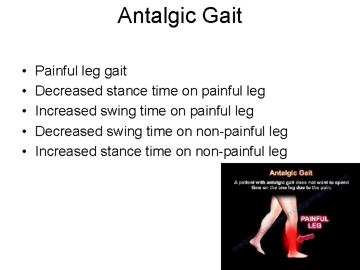 Antalgic Gait • • • Painful leg gait Decreased stance time on painful leg