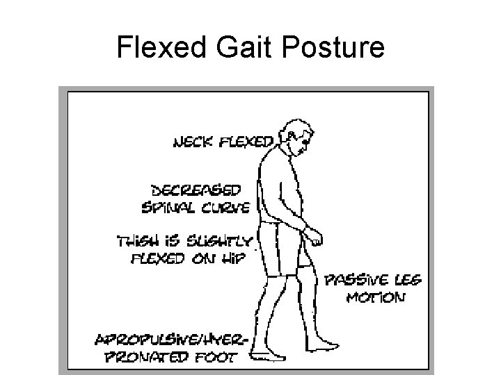Flexed Gait Posture 