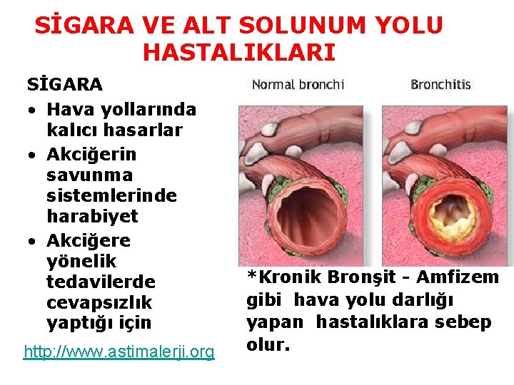 SİGARA VE ALT SOLUNUM YOLU HASTALIKLARI SİGARA • Hava yollarında kalıcı hasarlar • Akciğerin