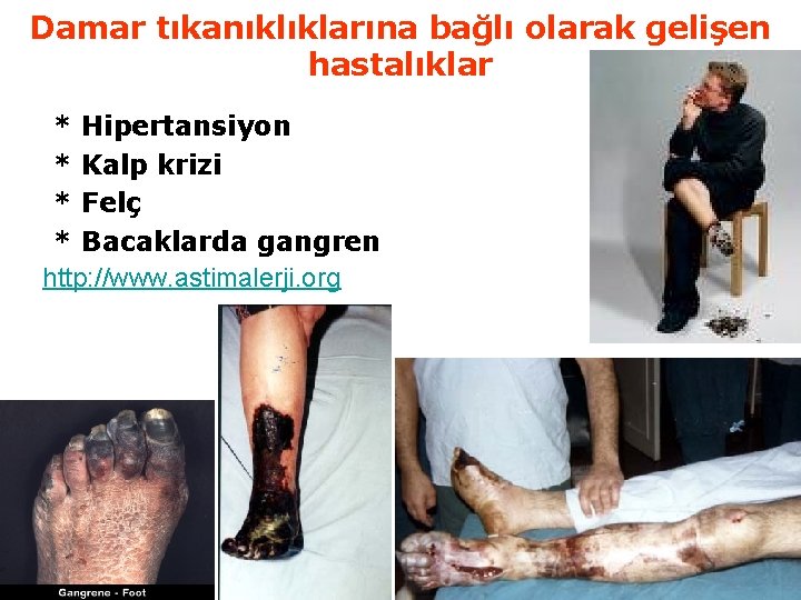 Damar tıkanıklıklarına bağlı olarak gelişen hastalıklar * Hipertansiyon * Kalp krizi * Felç *