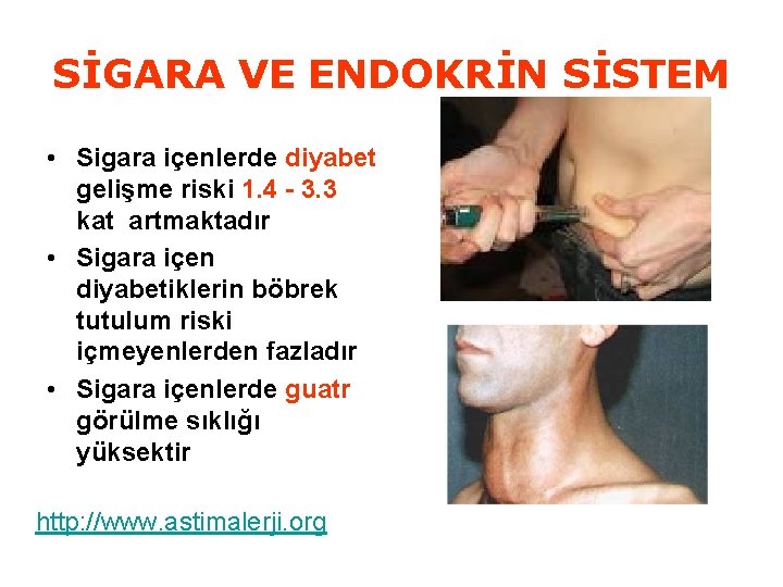 SİGARA VE ENDOKRİN SİSTEM • Sigara içenlerde diyabet gelişme riski 1. 4 - 3.