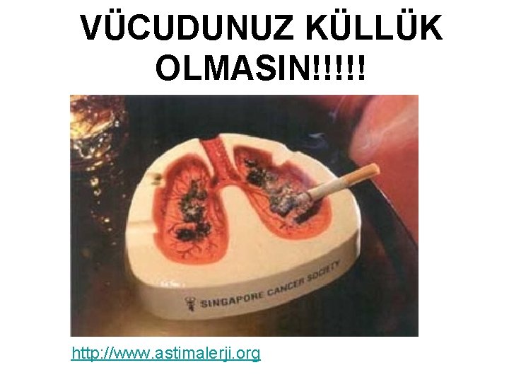 VÜCUDUNUZ KÜLLÜK OLMASIN!!!!! http: //www. astimalerji. org 