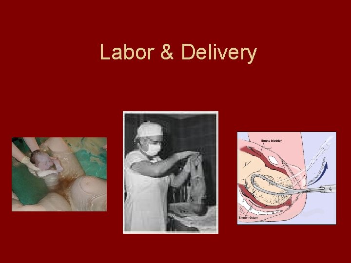 Labor & Delivery 