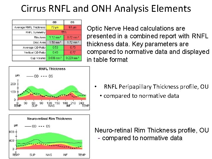 Cirrus RNFL and ONH Analysis Elements Optic Nerve Head calculations are presented in a