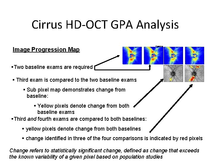 Cirrus HD-OCT GPA Analysis Image Progression Map Baseline §Two baseline exams are required §
