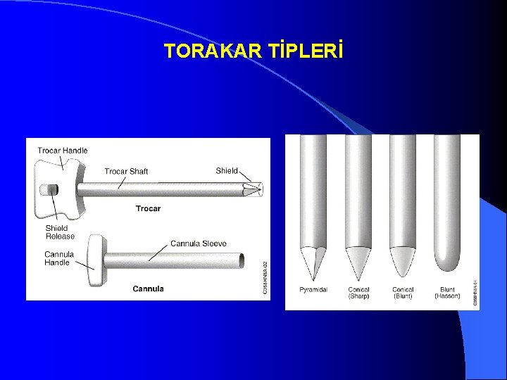 TORAKAR TİPLERİ 