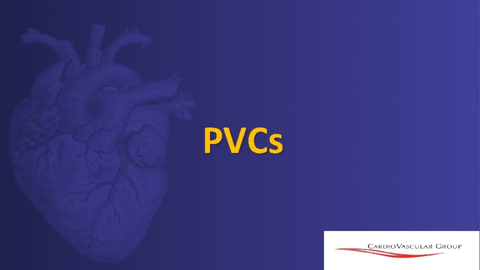 PVCs PVCs