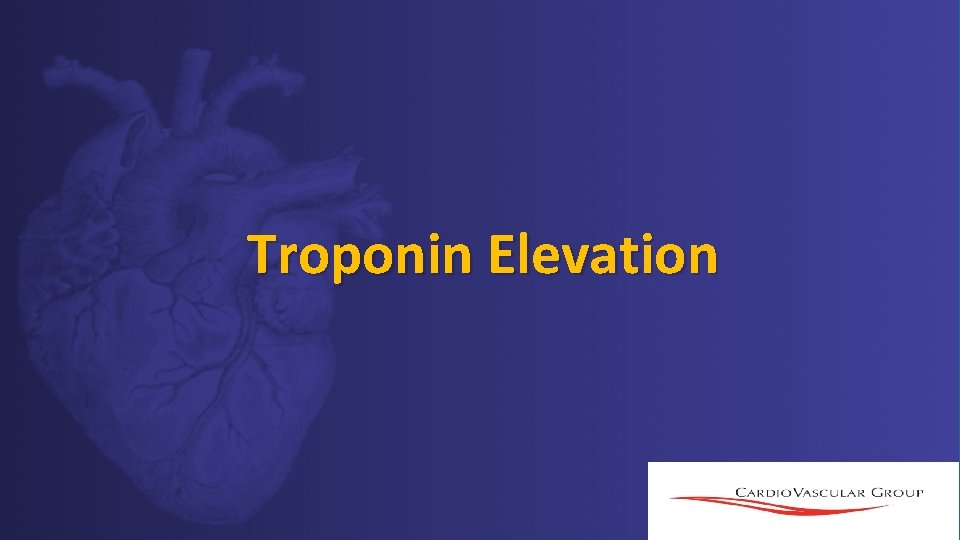 Troponin Elevation Troponin Elevation