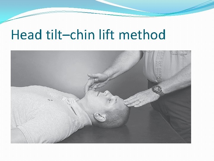 Head tilt–chin lift method 