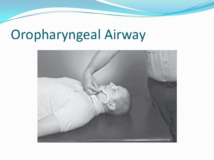 Oropharyngeal Airway 