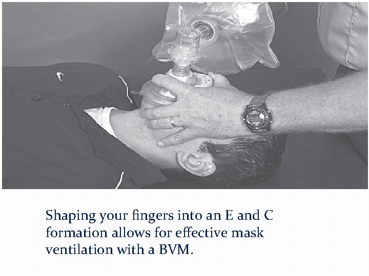 Shaping your fingers into an E and C formation allows for effective mask ventilation