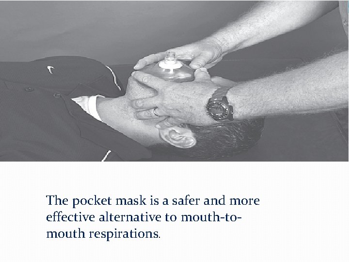 The pocket mask is a safer and more effective alternative to mouth-tomouth respirations. 