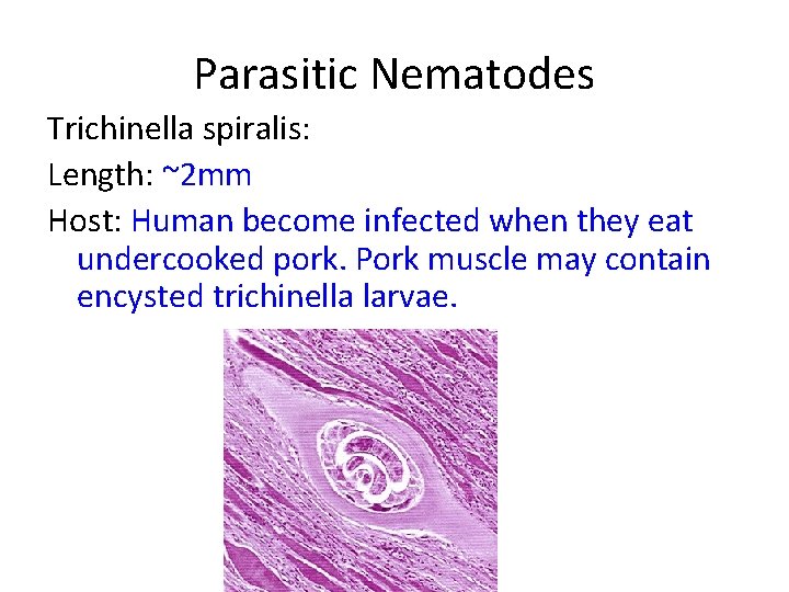 Parasitic Nematodes Trichinella spiralis: Length: ~2 mm Host: Human become infected when they eat