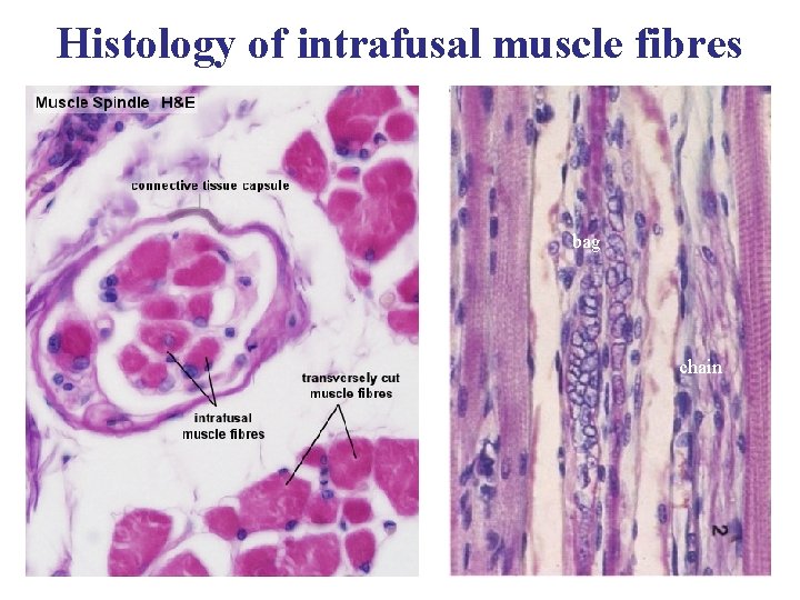 Histology of intrafusal muscle fibres bag chain 