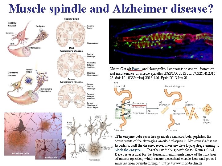 Muscle spindle and Alzheimer disease? Cheret C et al: Bace 1 and Neuregulin-1 cooperate