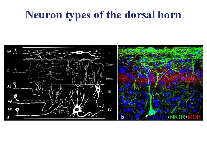 Neuron types of the dorsal horn 