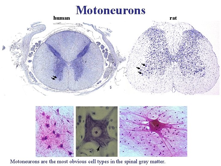 human Motoneurons are the most obvious cell types in the spinal gray matter. rat