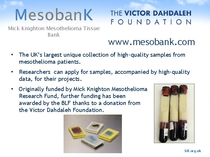 Mesoban. K Mick Knighton Mesothelioma Tissue Bank www. mesobank. com • The UK’s largest