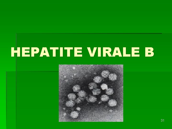 HEPATITE VIRALE B 31 