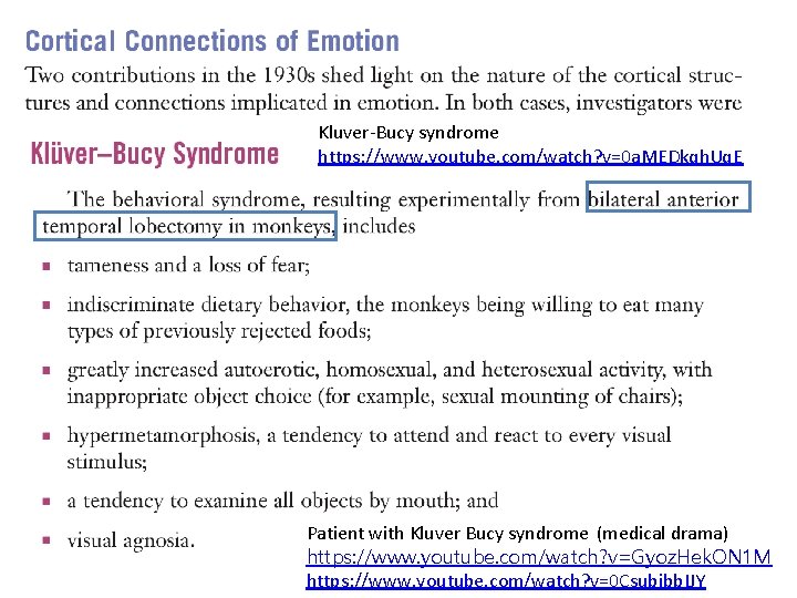 Kluver-Bucy syndrome https: //www. youtube. com/watch? v=0 a. MEDkqh. Uq. E Patient with Kluver Kluver-Bucy syndrome https: //www. youtube. com/watch? v=0 a. MEDkqh. Uq. E Patient with Kluver