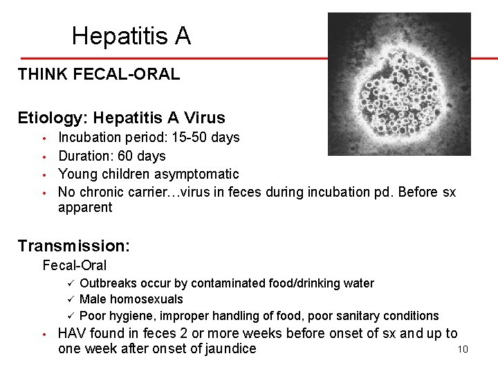 Hepatitis A THINK FECAL-ORAL Etiology: Hepatitis A Virus • • Incubation period: 15 -50