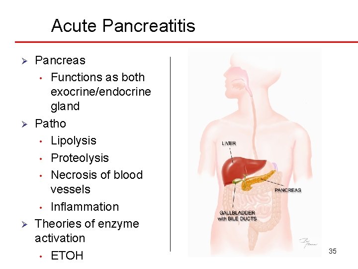 Acute Pancreatitis Ø Ø Ø Pancreas • Functions as both exocrine/endocrine gland Patho •