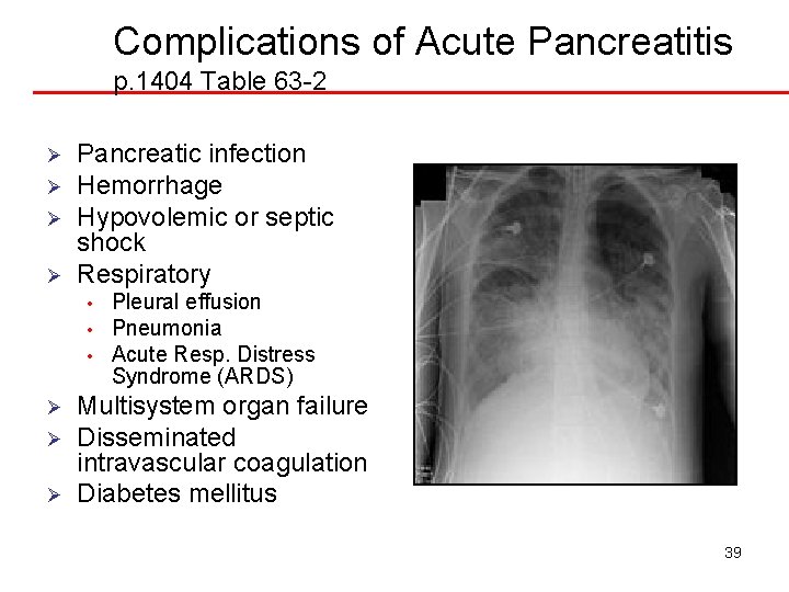 Complications of Acute Pancreatitis p. 1404 Table 63 -2 Ø Ø Pancreatic infection Hemorrhage