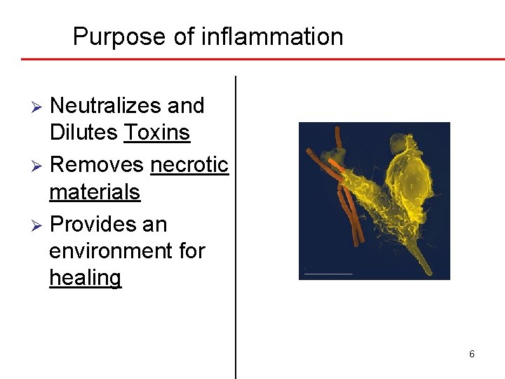 Purpose of inflammation Neutralizes and Dilutes Toxins Ø Removes necrotic materials Ø Provides an