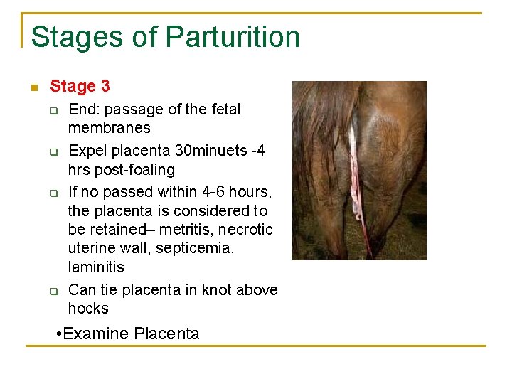 Stages of Parturition n Stage 3 q q End: passage of the fetal membranes