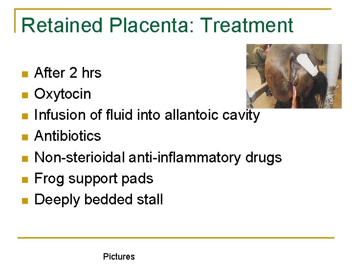 Retained Placenta: Treatment n n n n After 2 hrs Oxytocin Infusion of fluid