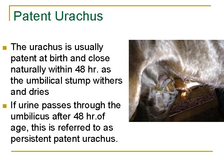 Patent Urachus n n The urachus is usually patent at birth and close naturally