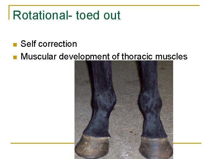 Rotational- toed out n n Self correction Muscular development of thoracic muscles 