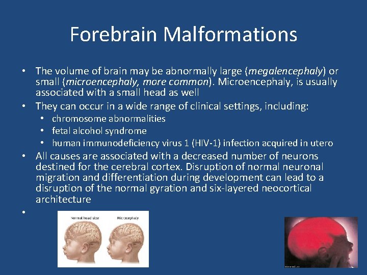 Forebrain Malformations • The volume of brain may be abnormally large (megalencephaly) or small