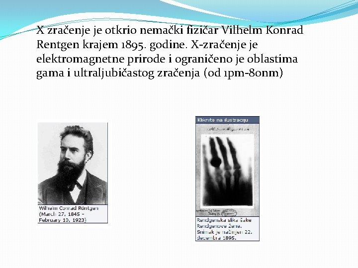 X zračenje je otkrio nemački fizičar Vilhelm Konrad Rentgen krajem 1895. godine. X-zračenje je