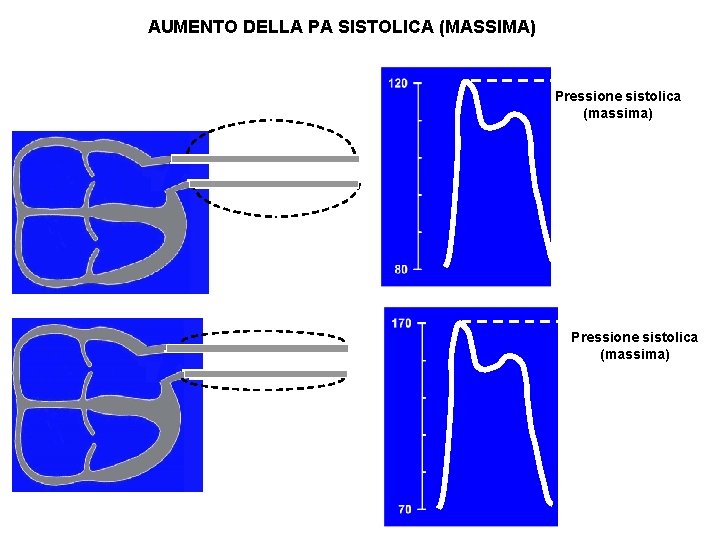 AUMENTO DELLA PA SISTOLICA (MASSIMA) Pressione sistolica (massima) 21 