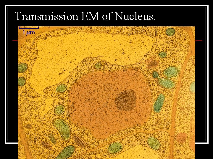 Transmission EM of Nucleus. 